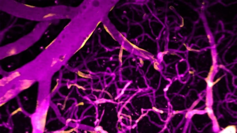 Los genes humanos de evolución más rápida están relacionados con cambios evolutivos en el desarrollo del cerebro Los genes humanos de evolución más rápida están relacionados con cambios evolutivos en el desarrollo del cerebro